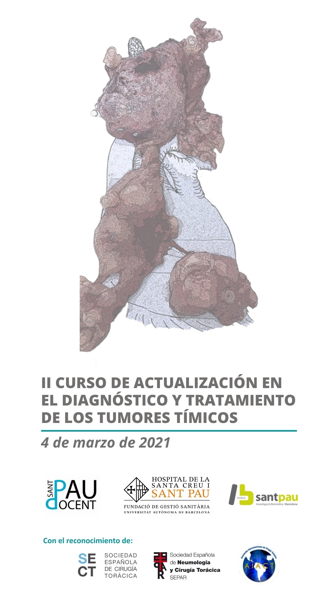 II Curs d’Actualització en Diagnòstic i Tractament dels Tumors Tímics