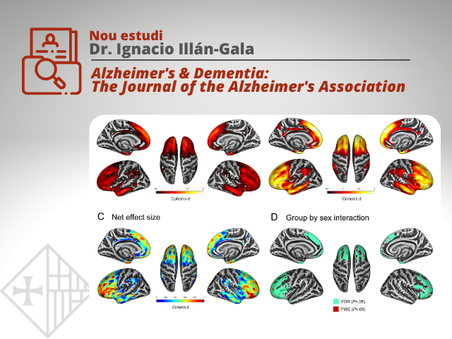 Sant Pau publica un estudi que revela importants diferències lligades al sexe en pacients amb demència frontotemporal