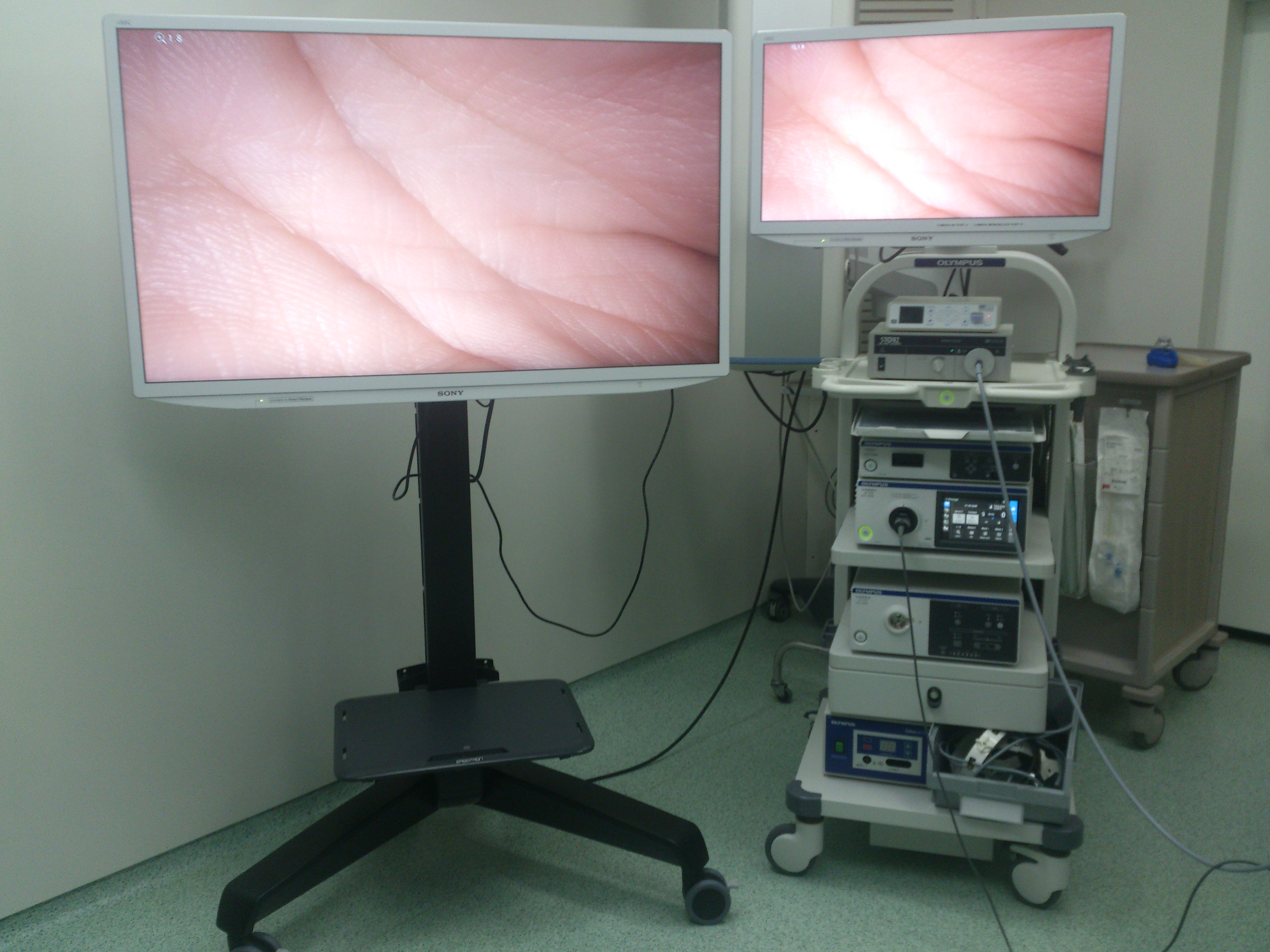 Sant Pau incorpora la imatge 4K a la cirurgia d’Otorinolaringologia